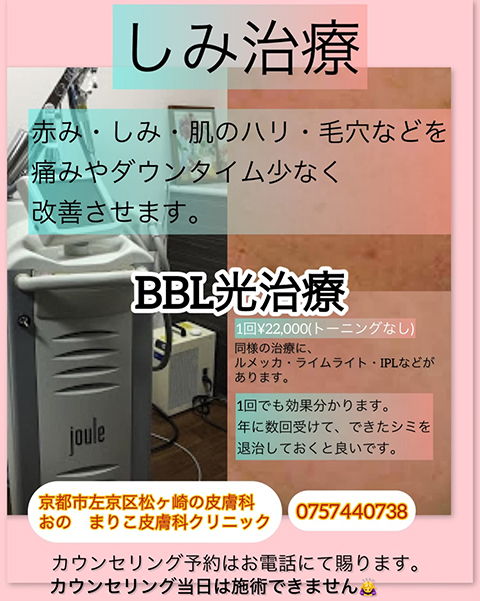 しみ治療