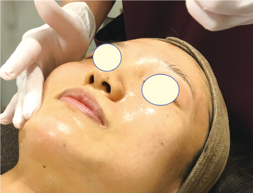 プラズマシャワー | 京都 北山 松ヶ崎にある皮膚科｜しげまりこ皮膚科 